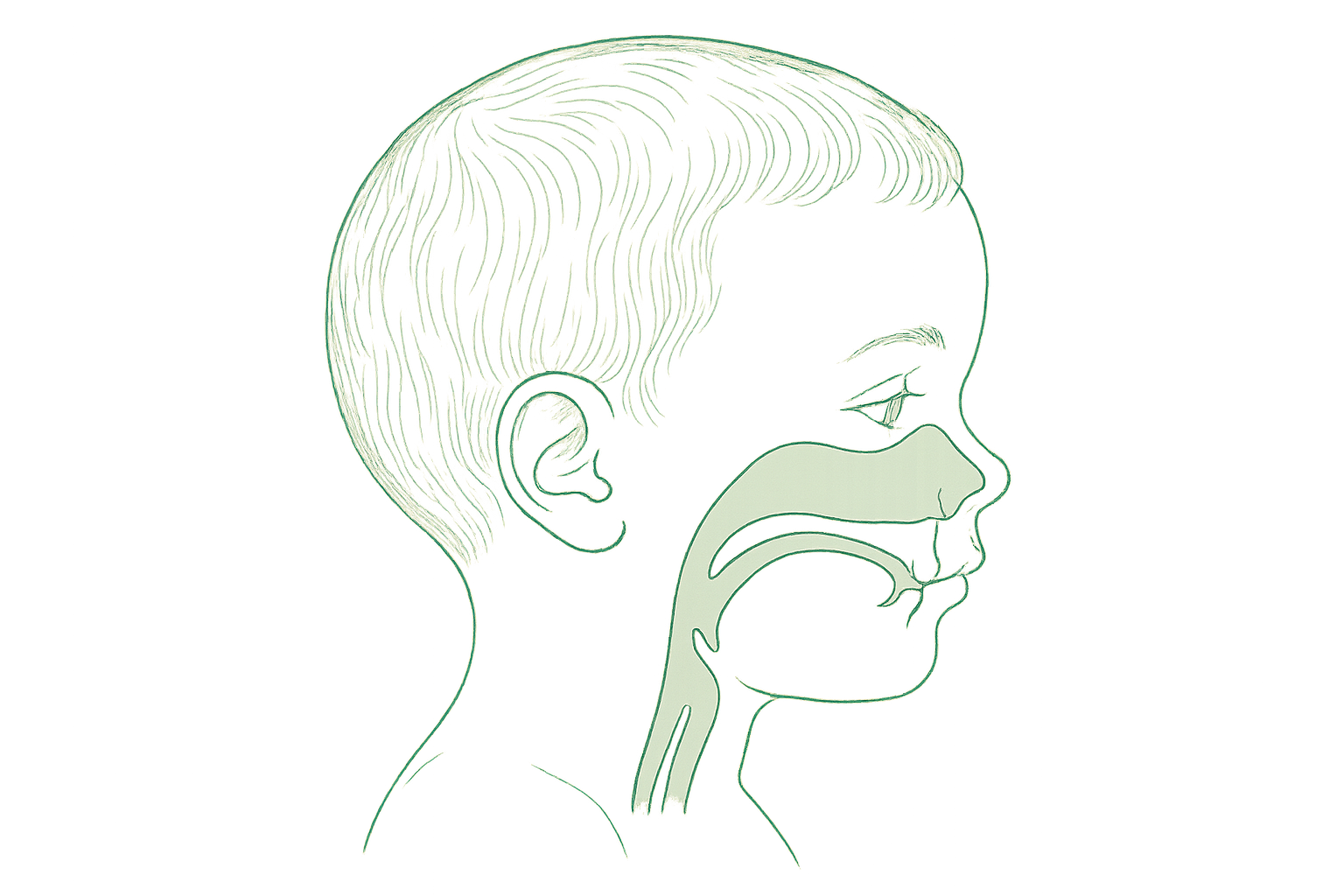 Editorial line illustration of a child's nasal passage and airway