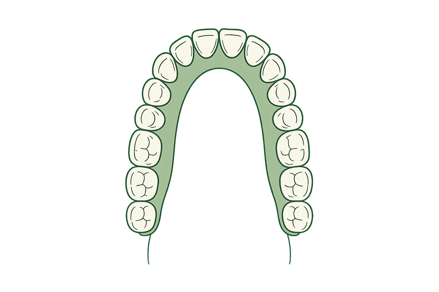 Editorial line illustration of a narrow dental arch